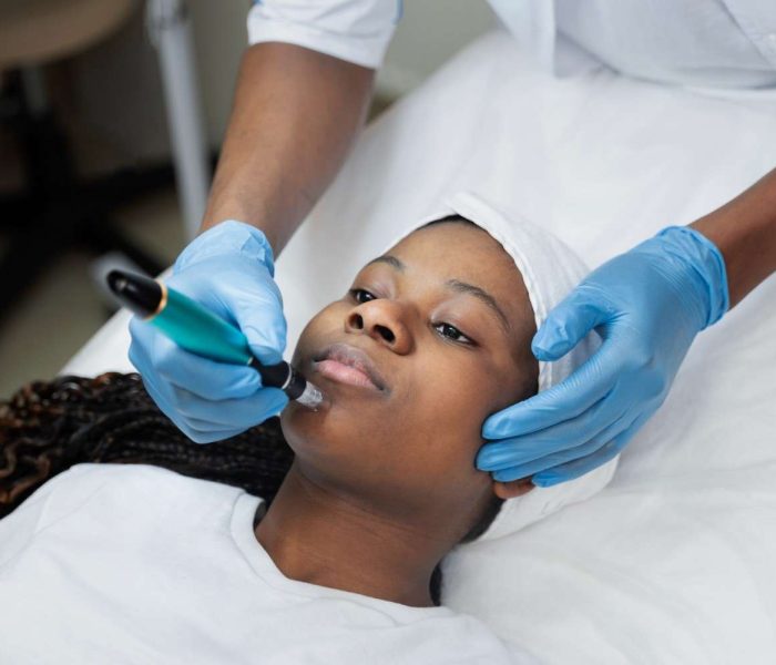 person-getting-micro-needling-beauty-treatment1